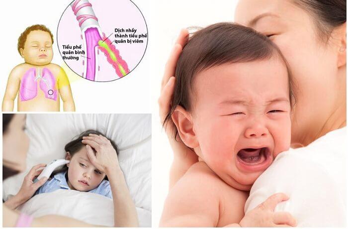 Viêm phế quản ở trẻ khi giao mùa