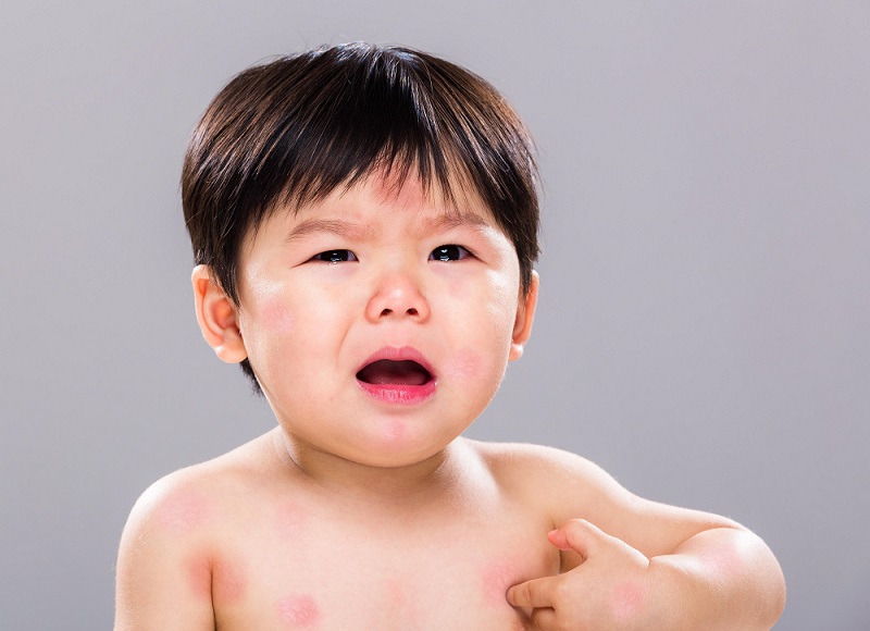 Đánh giá dị ứng đạm sữa bò