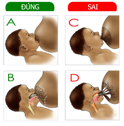 Điều chỉnh cách cho trẻ bú