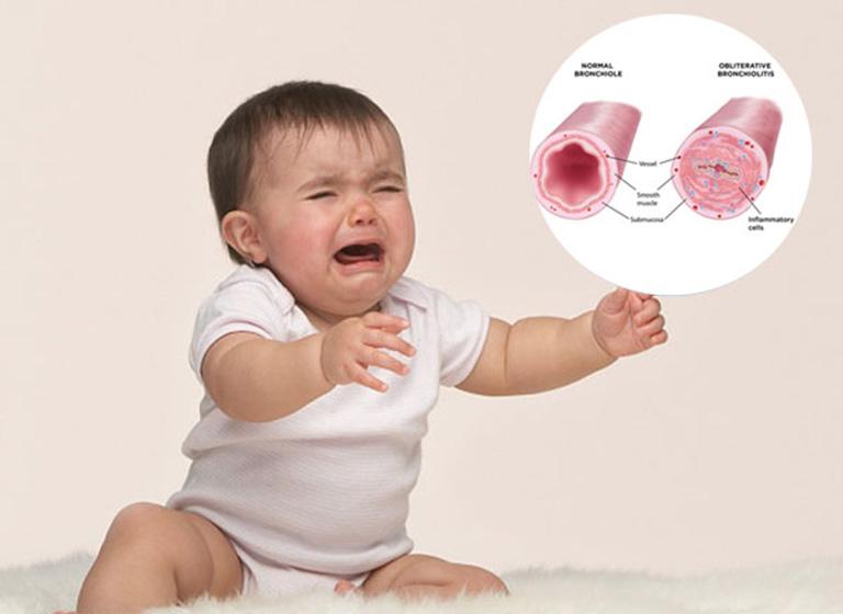Khi đường hô hấp bị viêm và tiết ra chất nhầy, trẻ có dấu hiệu khó thở, ho dữ dội