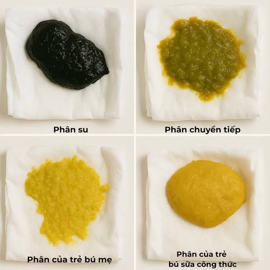 Trẻ sơ sinh không đi phân su