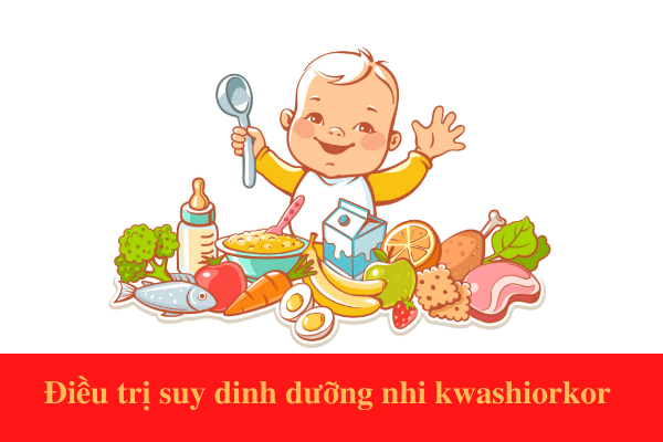 Điều trị suy dinh dưỡng nhi thể Kwashiorkor như thế nào?