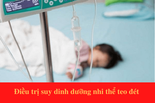 Suy dinh dưỡng nhi thể teo đét điều trị như thế nào?