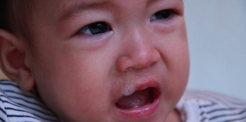Viêm phế quản ở trẻ là gì?