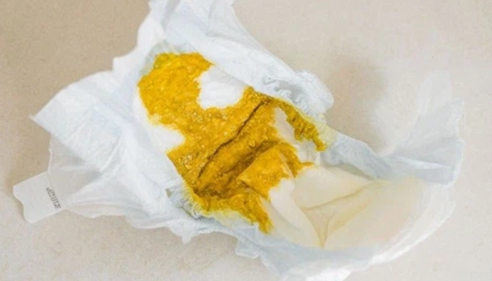 Phân nhầy ở trẻ 3 tháng tuổi là gì?